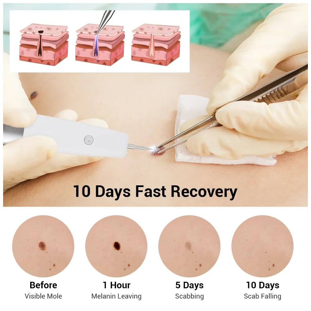 Perfect Skin - Stylo Anti Taches