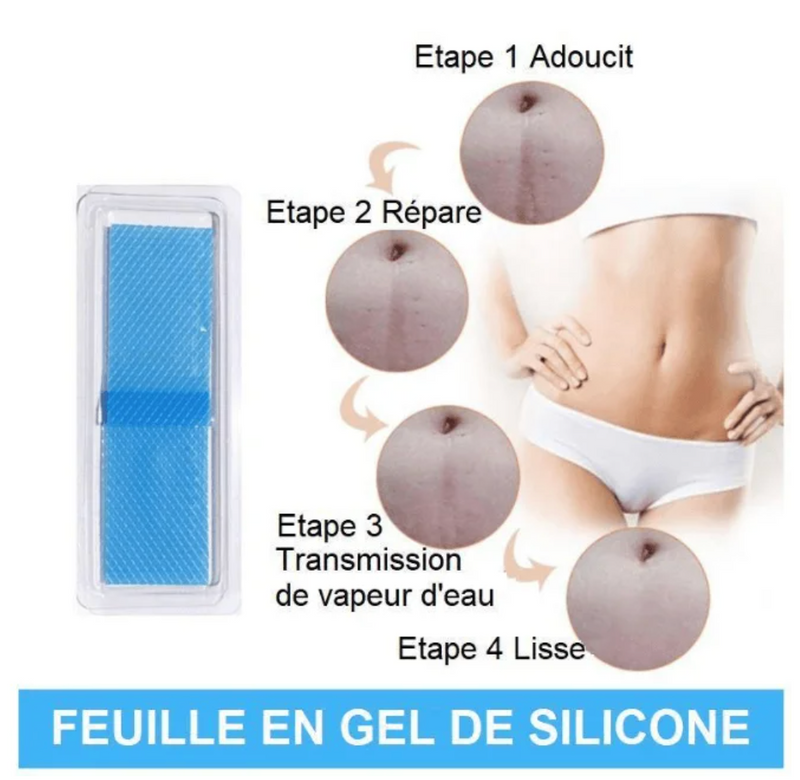 2x Patchs réutilisables de silicone pour cicatrices et vergetures