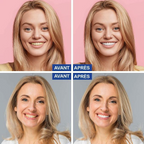 14x Bandes blanchiment dentaire