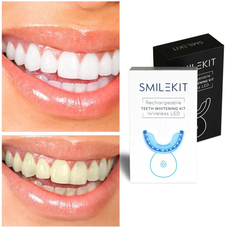 SMILEKIT - Kit de blanchiment dentaire Pro