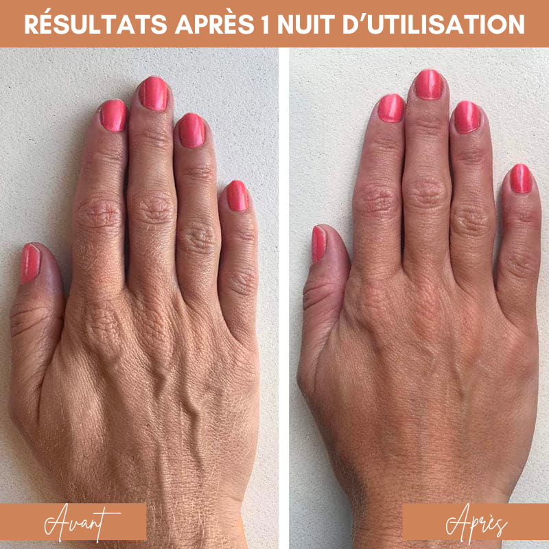 2x Patchs anti-rides réutilisables - Spéciales Mains