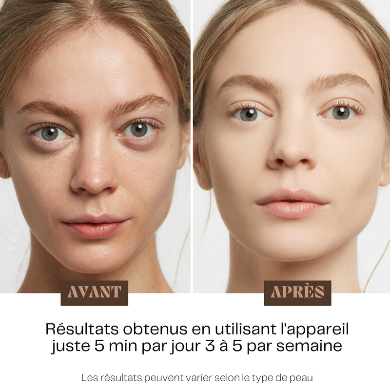 LUMILIFT - Appareil de soin visage luminothérapie