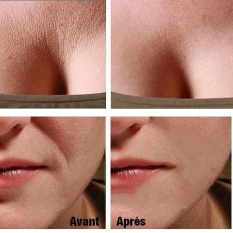 Patchs réutilisables anti-rides - 16 pièces