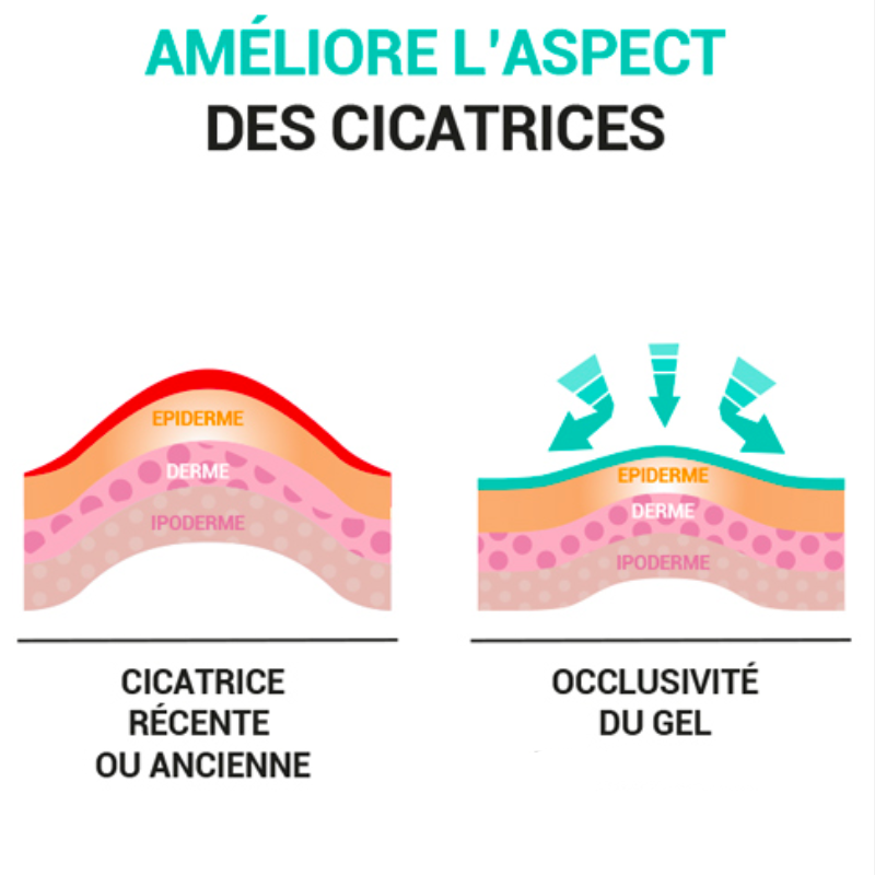 2x Patchs réutilisables de silicone pour cicatrices et vergetures