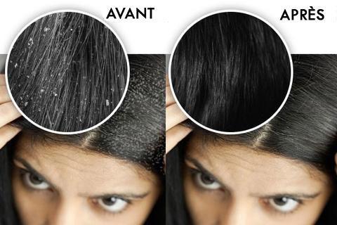 Brosse Massante cuir chevelu 1 ACHETÉE = 1 OFFERTE