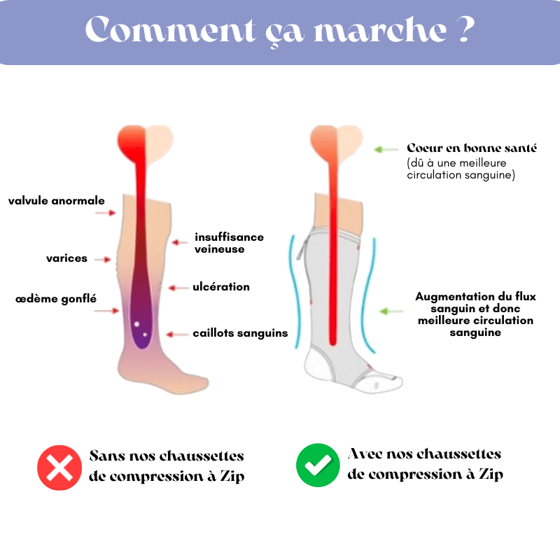 Chaussettes de Compression à Zip