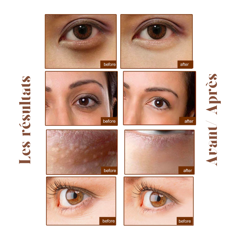 20x Patchs yeux anti-cernes Or Collagène & Acide Hyaluronique